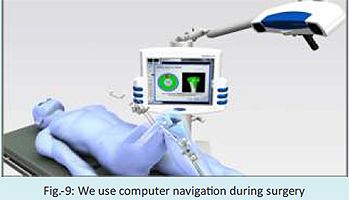 How we have perfected the technique of knee replacement?